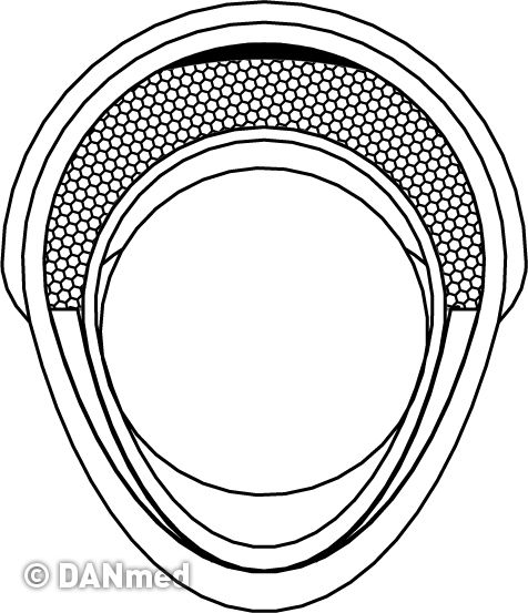 sa1019_pfta_fts-040-600_storz%20(1).jpg