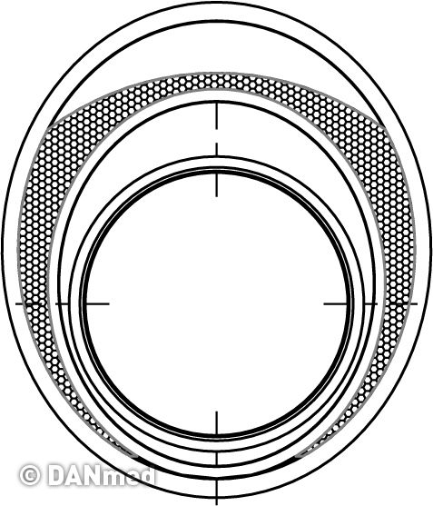sa1771_pfta_ftn-040-300_hsw-s_p%20(3).jpg